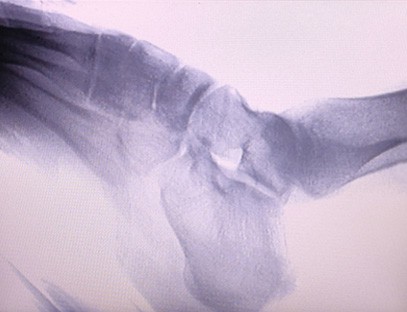 Ankle joint display details Ankle joint display details